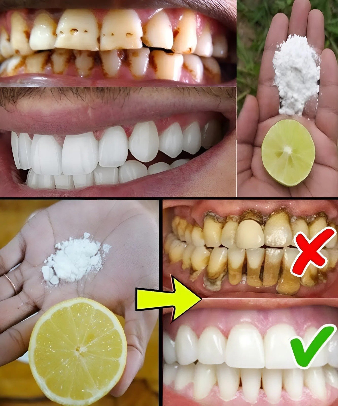 ✨ Dazzle with a Radiant Smile: The Lemon and Baking Soda Secret