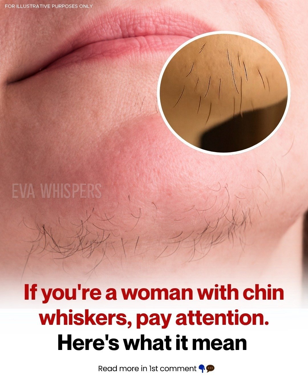 Chin Hair in Women: What It Could Mean for Your Health