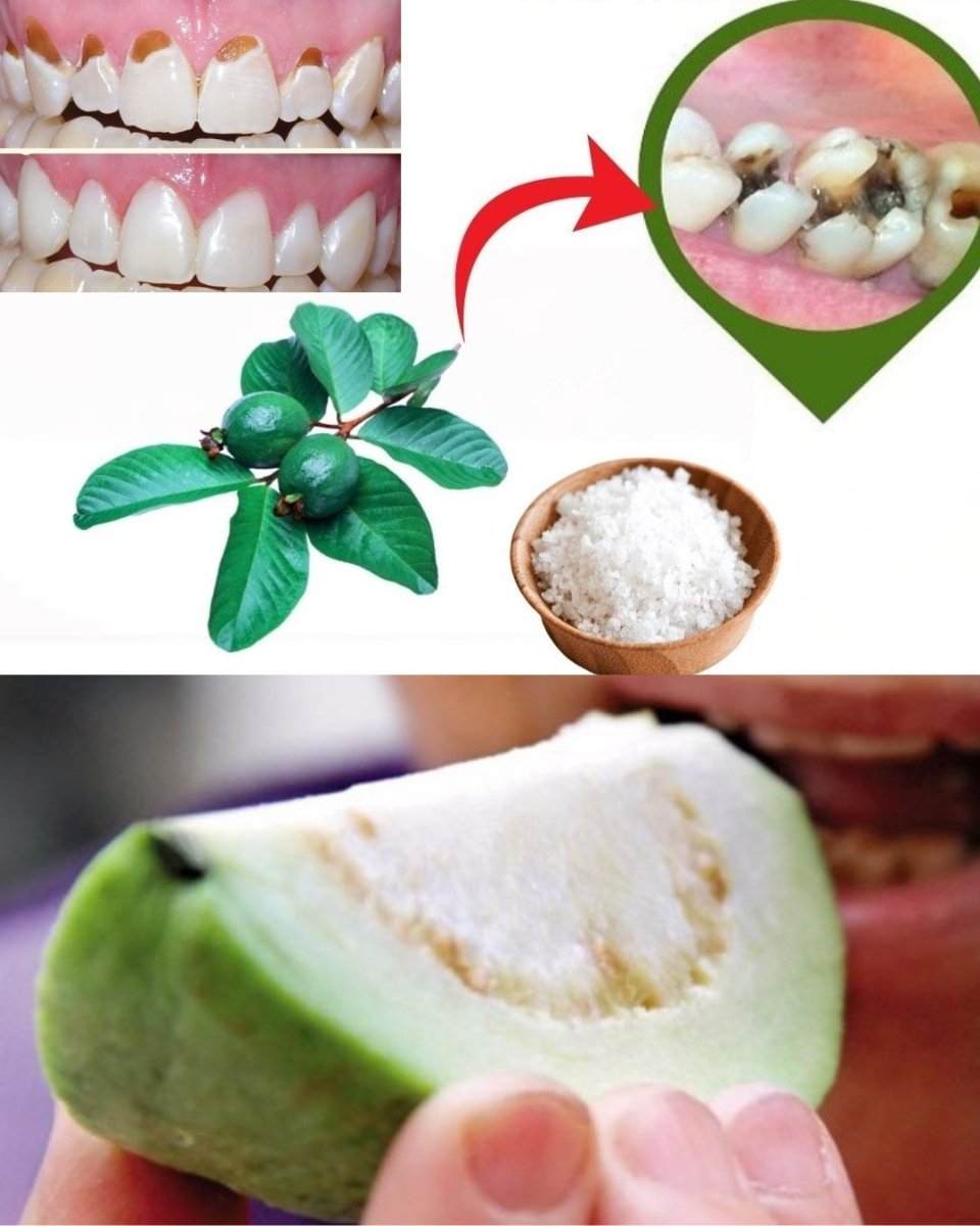 🌿 Discover Nature’s Secret: 3 Powerful Guava Leaf Remedies to Support Oral Health & Reduce Tooth Decay