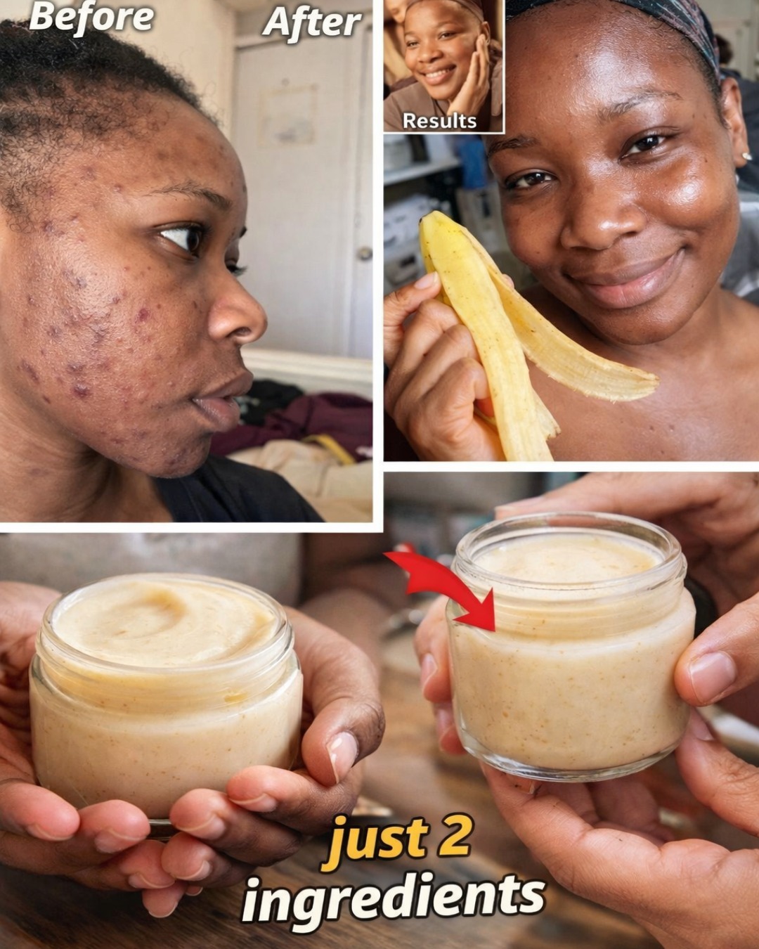 7 Natural Ways to Smooth Fine Lines & Boost Skin Glow Using Banana Peels