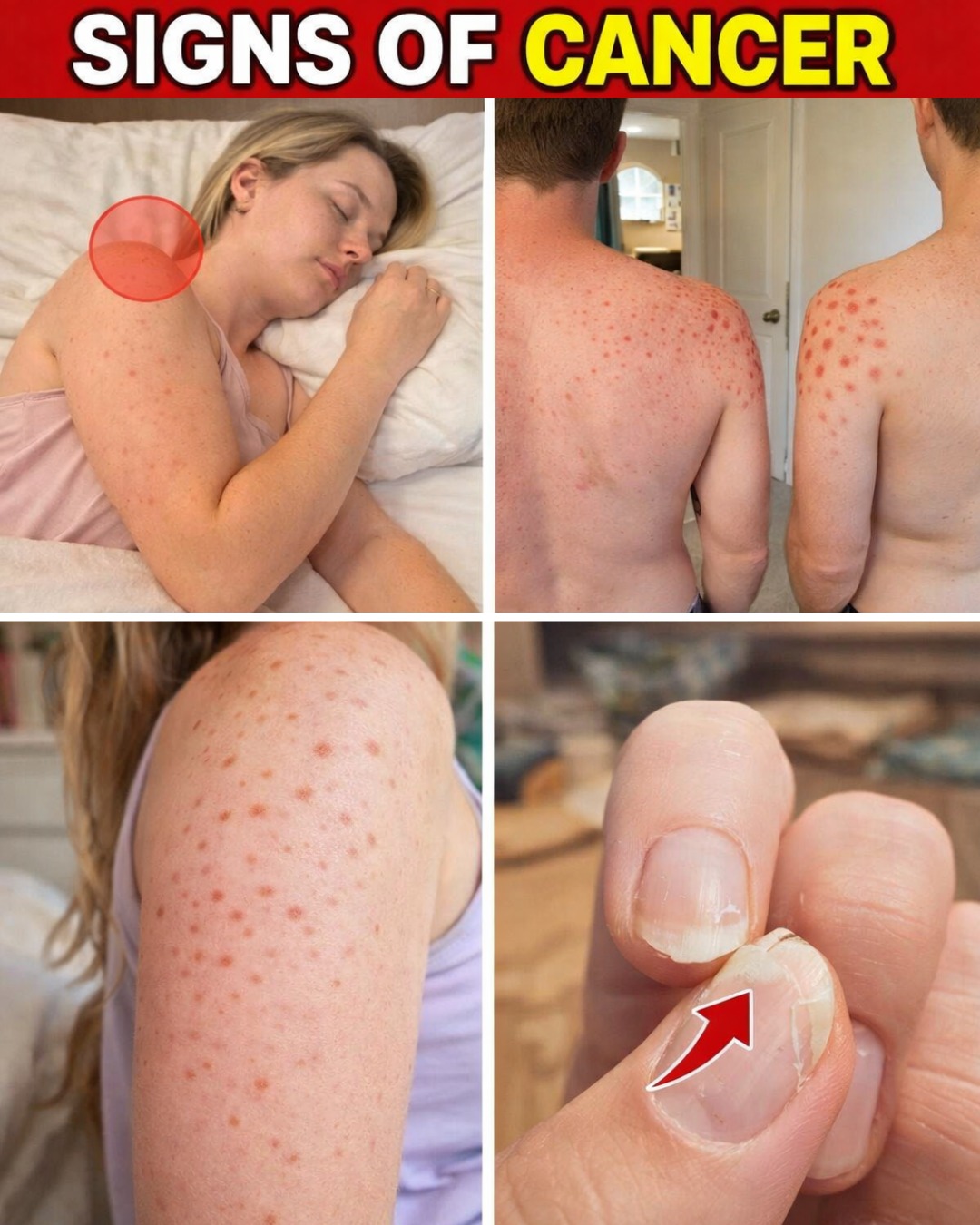 10 Hidden Cancer Warning Signs… Ignoring Them Could Be Deadly