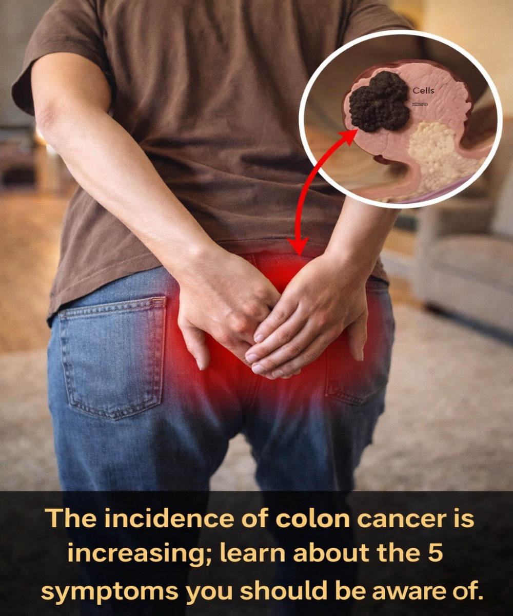 Colon Cancer Rates Are Rising Fast: 5 Warning Signs You Can’t Afford to Ignore