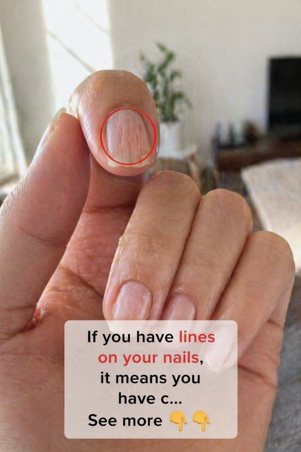 What Those Vertical Ridges and Horizontal Lines on Your Nails Could Be Telling You About Your Body