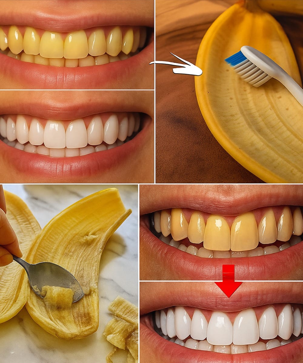 The Banana Peel Secret Dentists Keep Hidden: Whiten Teeth in Just 2 Minutes!