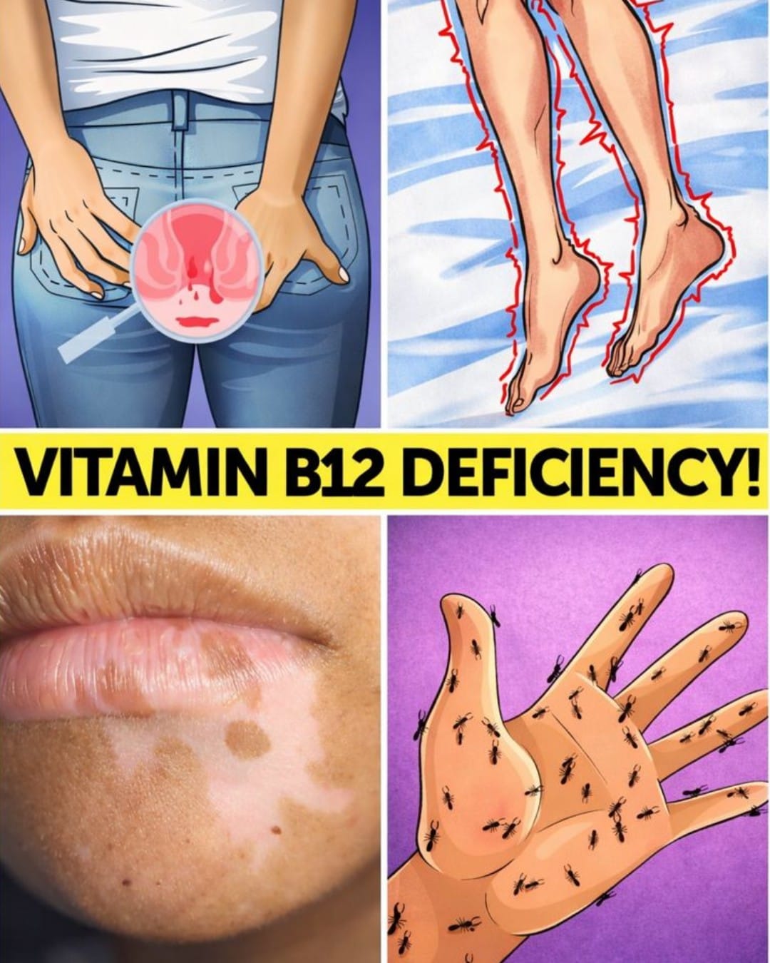 8 Strange Signs Your Body Is Begging for More Vitamin B12 – Don’t Ignore These Red Flags