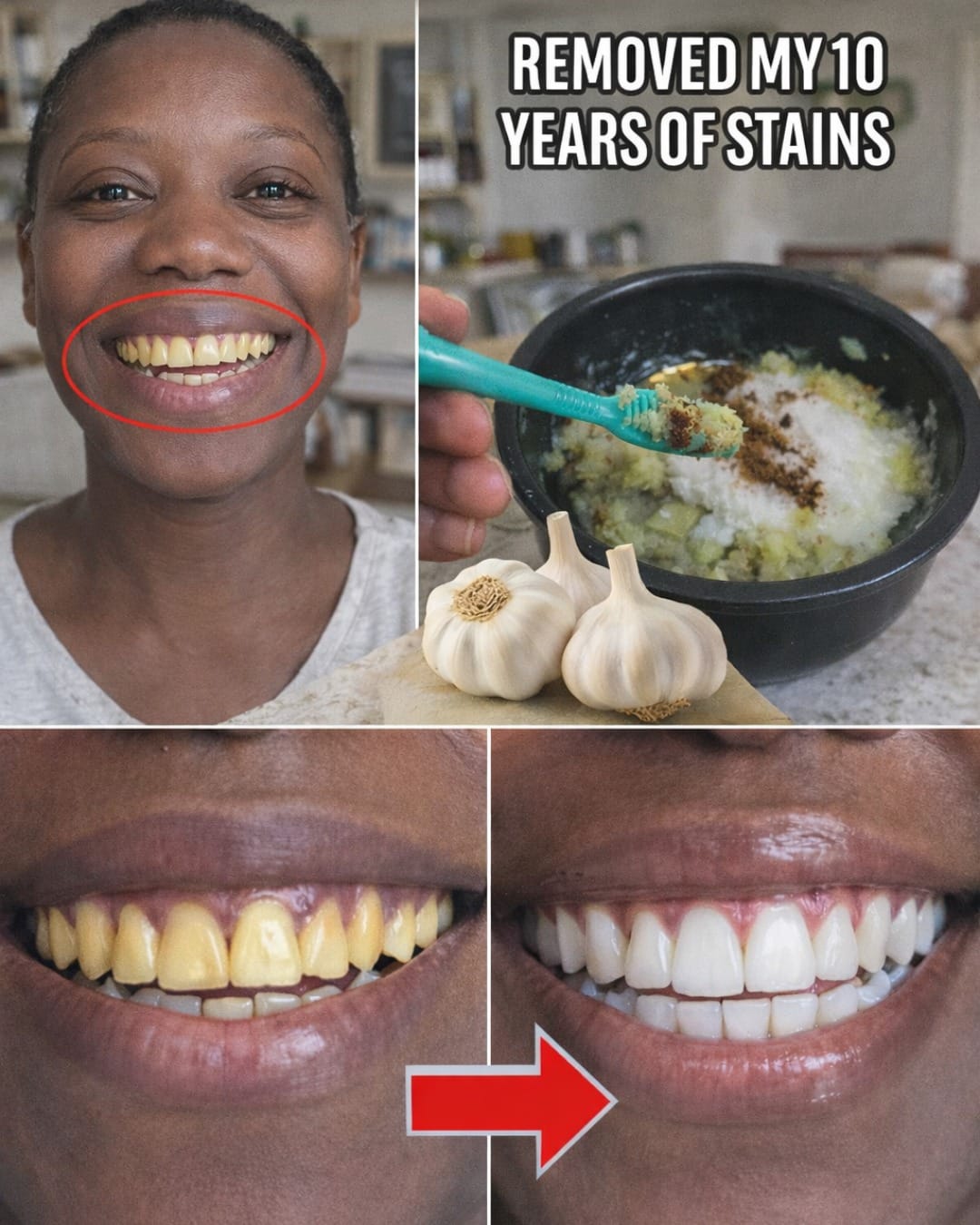 In Two Minutes, Remove 10 Years of Stains from Your Teeth! The Results Will Shock You