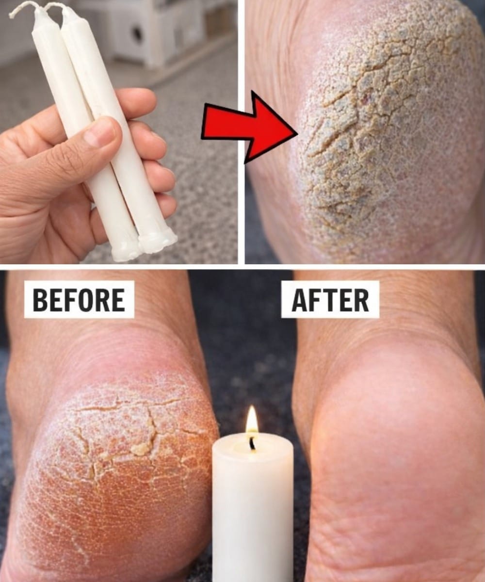 Soften, Heal, and Restore Your Feet Overnight with Candle Wax