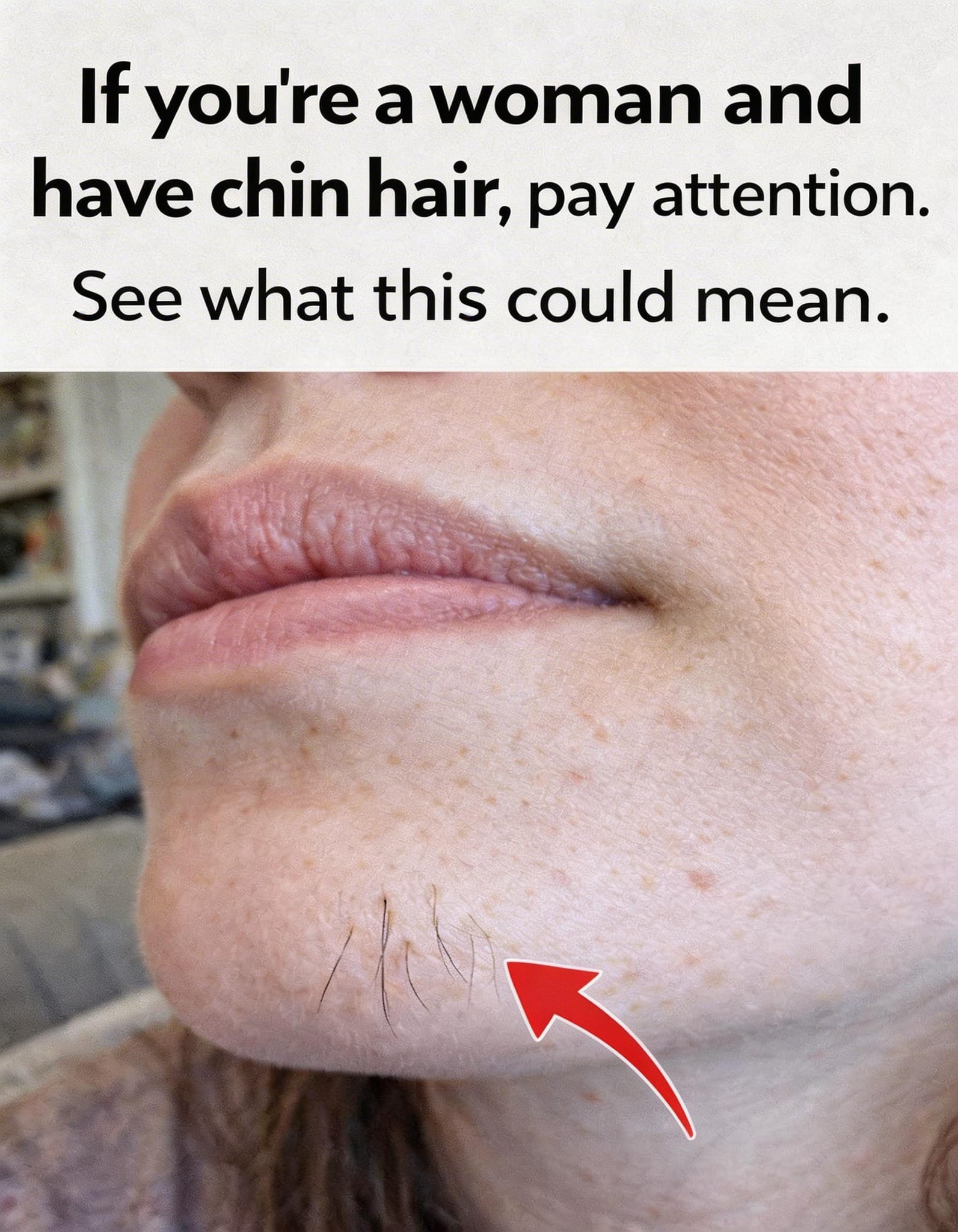 Chin Hair in Women: What Causes It and When to Pay Attention to Your Hormones