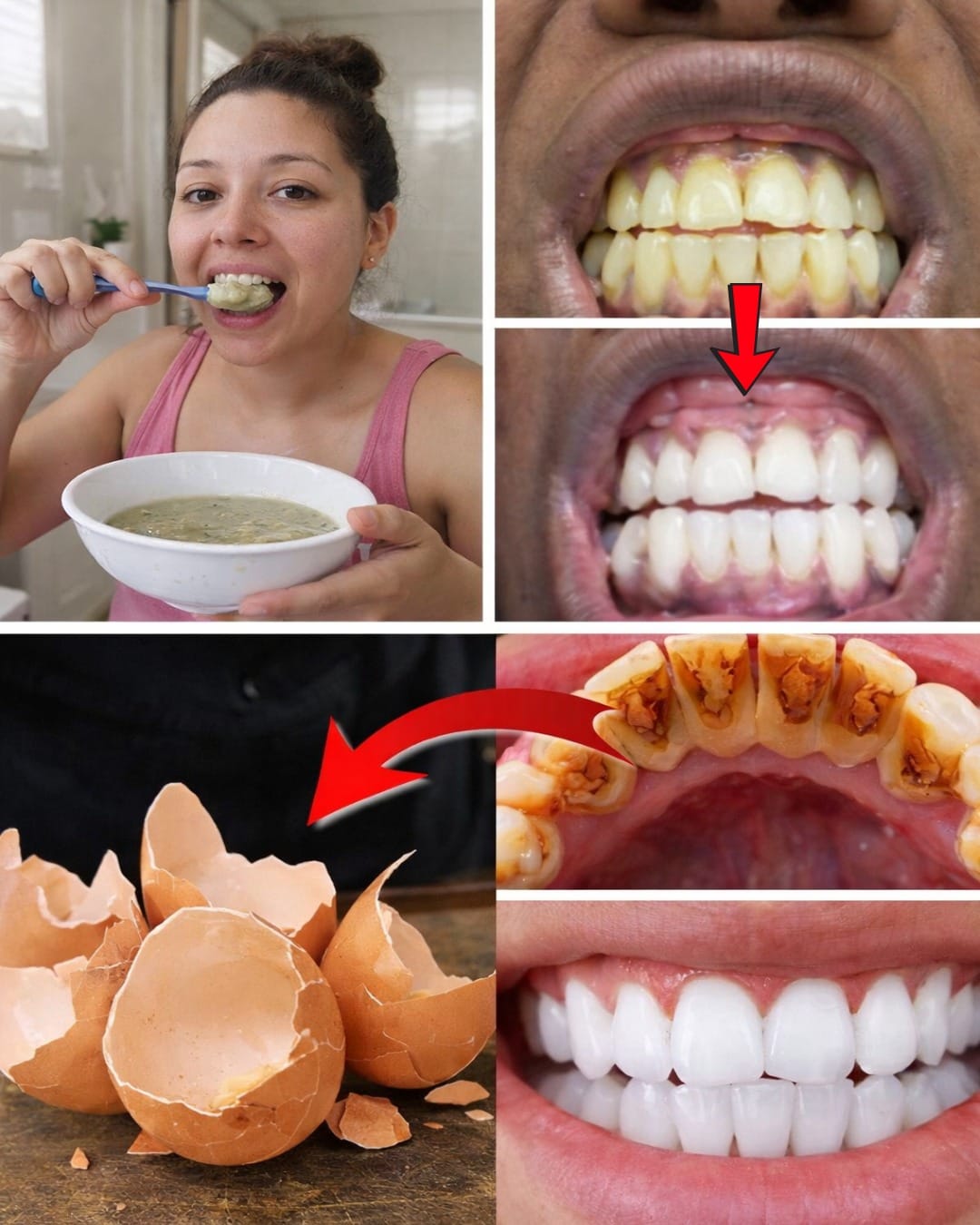 Egg and Coffee Teeth Whitening: The Viral Home Remedy That May Brighten Yellow Teeth – What Really Works and What to Watch Out For