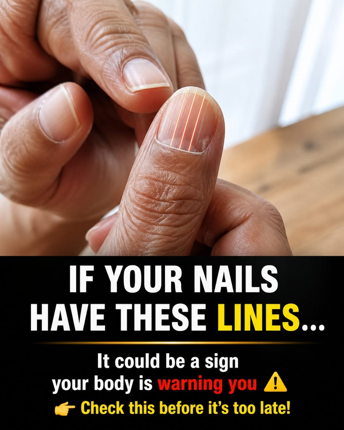 Lines on Your Fingernails Can Expose What Your Body Is Missing