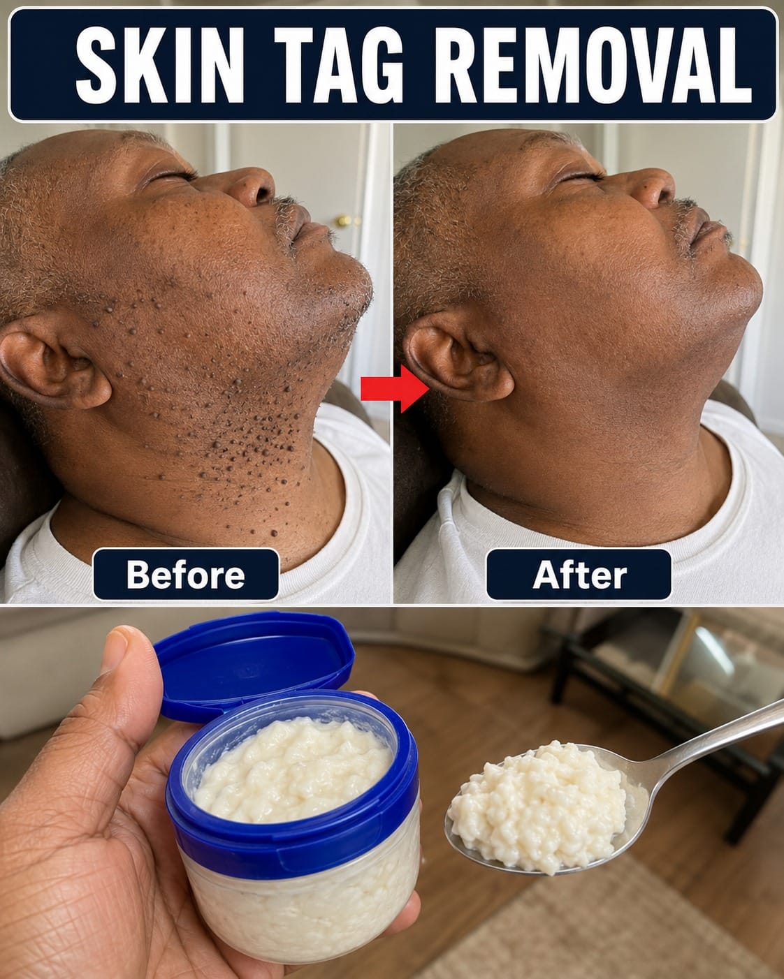 How to Remove Skin Tags in One Night: Safe Methods Dermatologists Actually Recommend