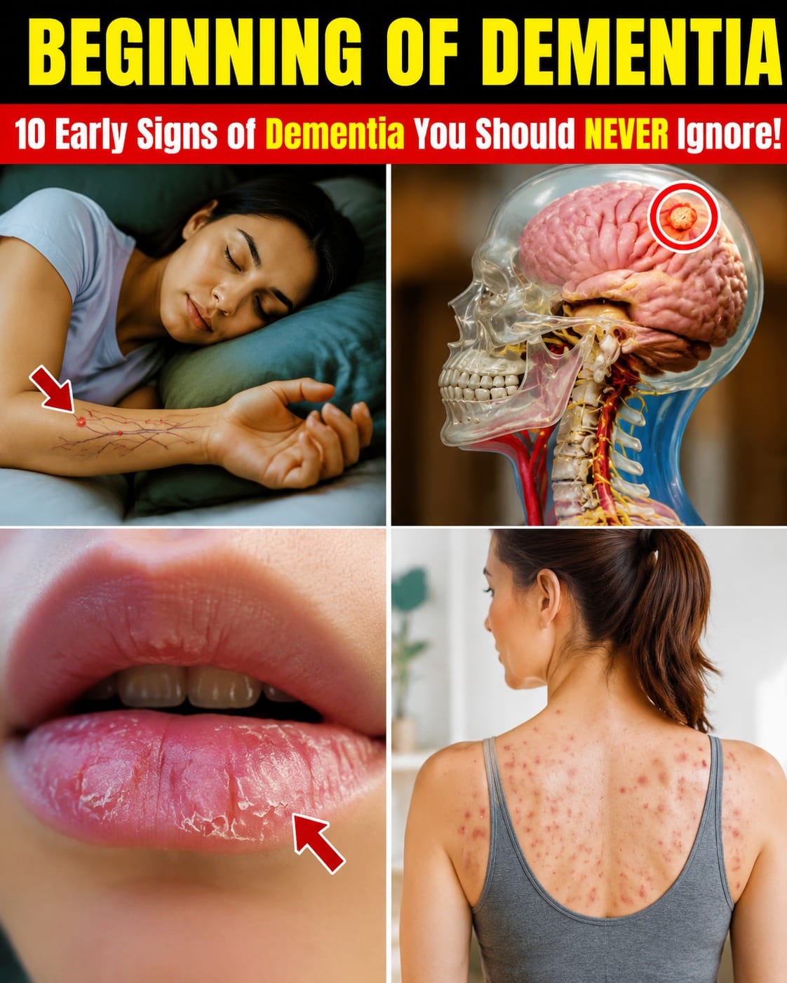10 Early Signs of Dementia You Should Never Ignore