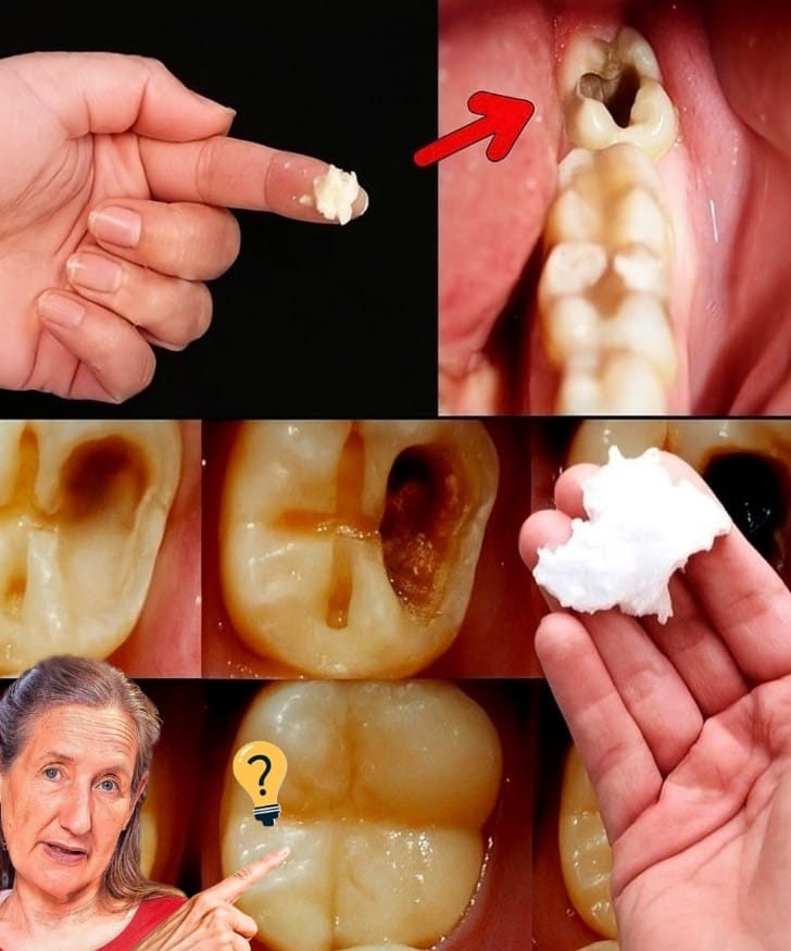 🦷 Natural Ways to Prevent Cavities and Strengthen Your Smile