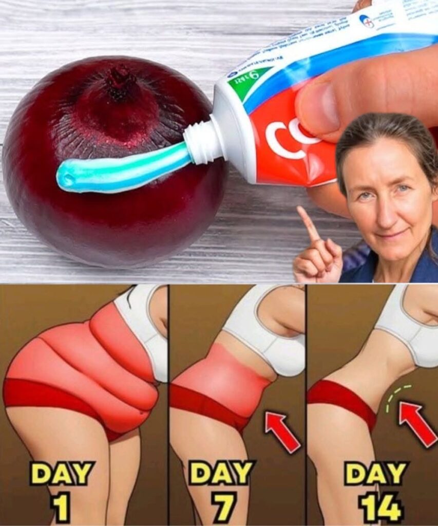 Lose Belly Fat Overnight: Onion + Toothpaste