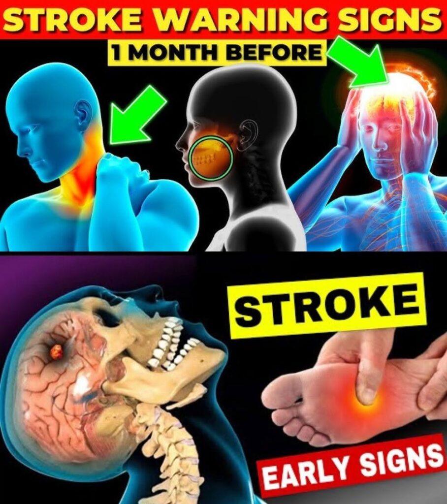 10 Warning Signs of Stroke That Can Occur Before a Major Stroke