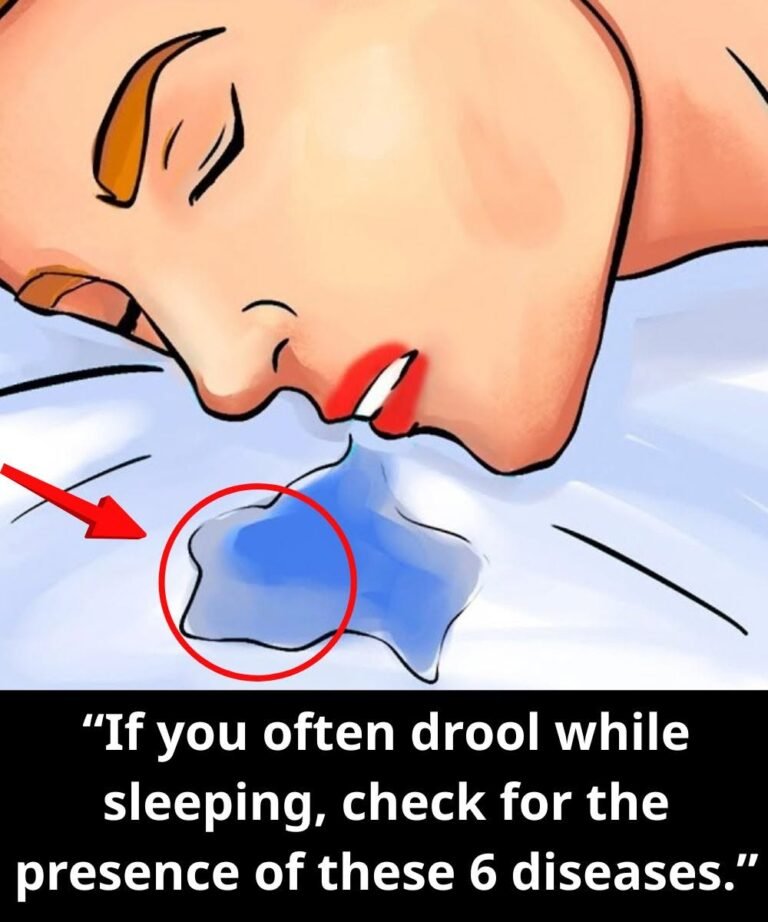 If You Often Drool While Sleeping, Check for These 6 Health Conditions