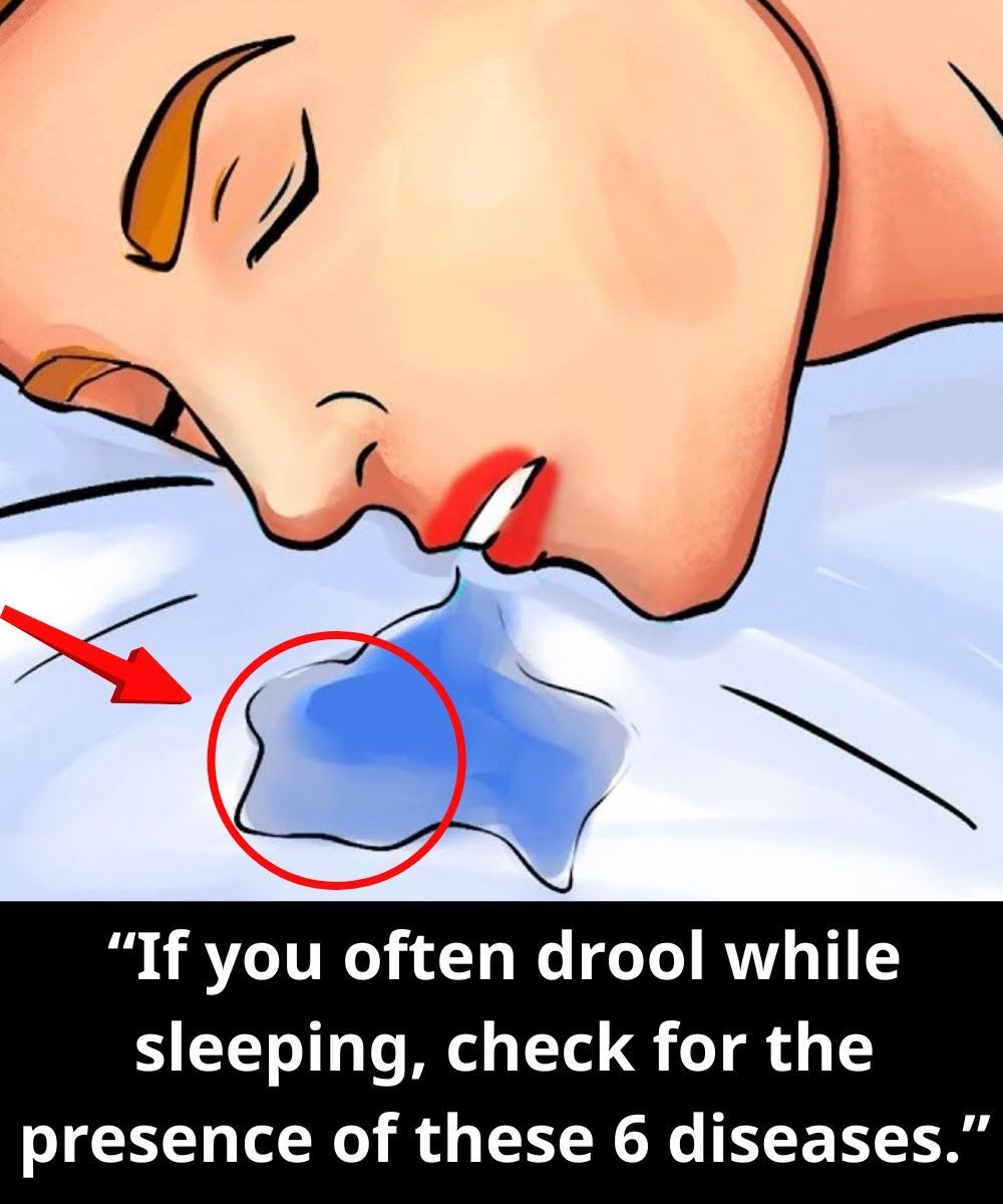 If You Often Drool While Sleeping, Check for These 6 Health Conditions
