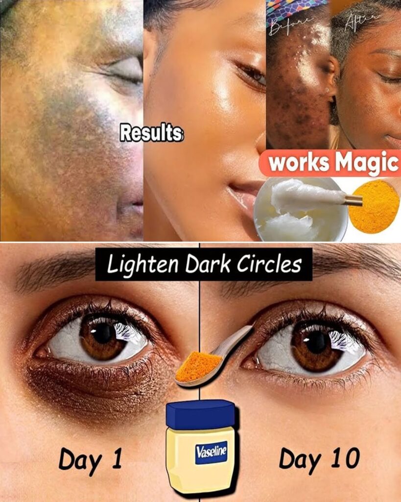 Fade Dark Spots with Vaseline-Turmeric Mask