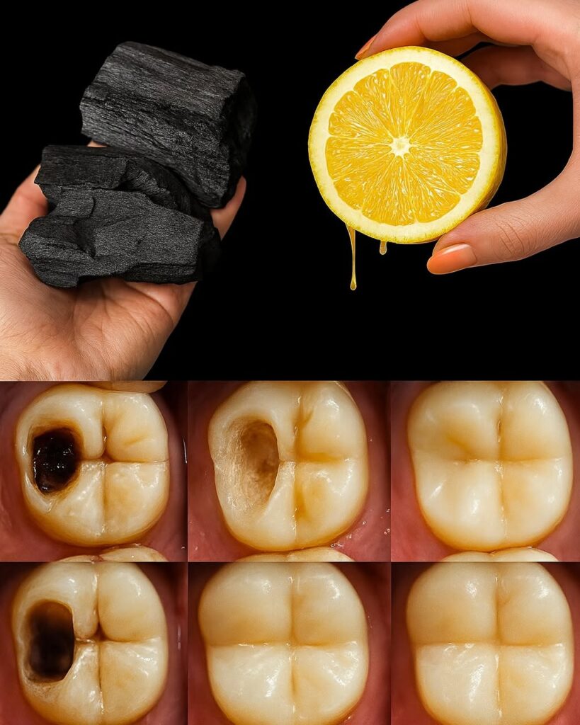 How to naturally repair a cavity. Keep these tips in mind to avoid visiting the dentist