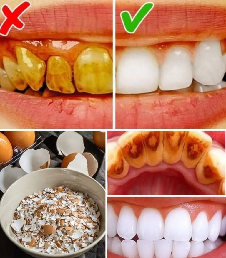 Eggshell Powder for Teeth: Benefits, Uses, and Safety Tips
