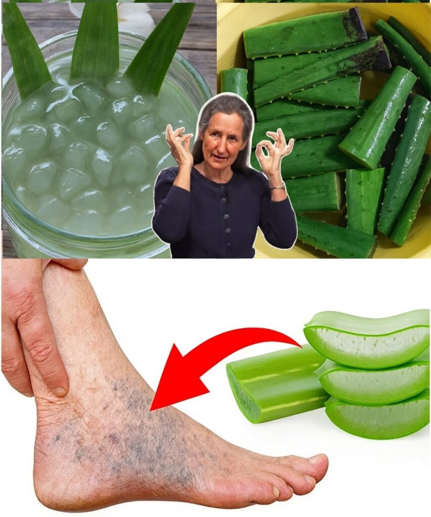 Say Goodbye to Heavy, Tired Legs with This Simple Aloe Vera Ritual