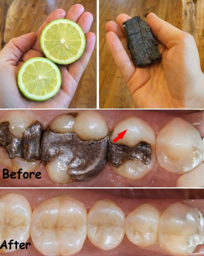 Simple Natural Tips to Support Healthy Teeth – Everyday Habits to Help Maintain Oral Wellness as You Age