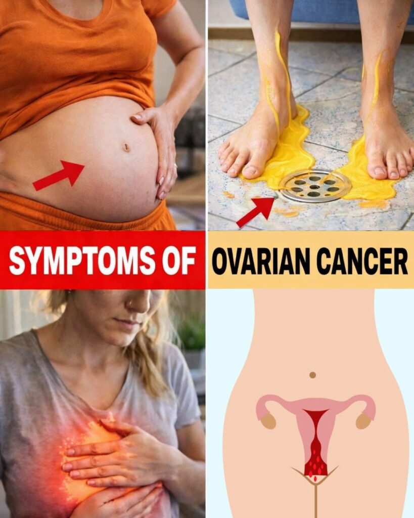 6 Subtle Warning Signs of Ovarian Cancer That Most Women Overlook