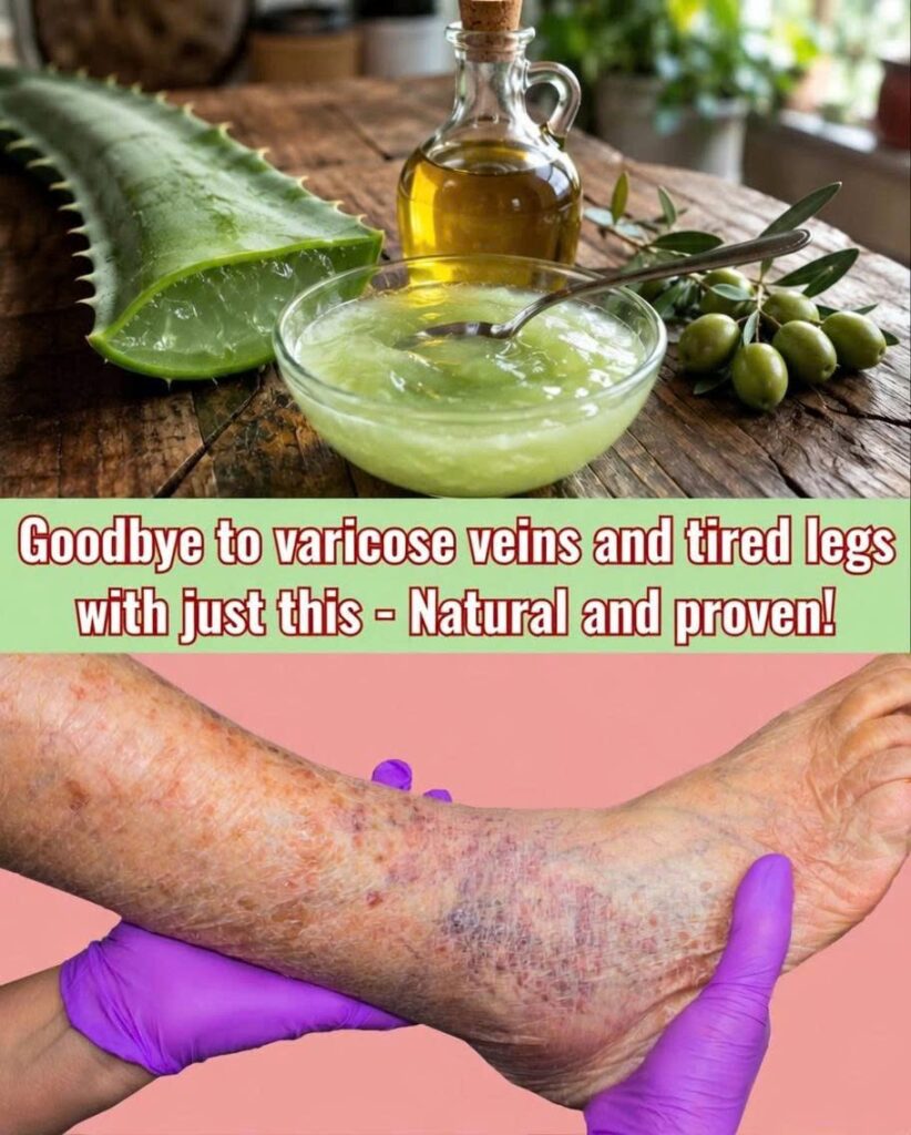 Aloe Vera for Tired Legs and Vein Wellness: Benefits, Uses, and Natural Self-Care Tips