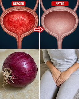 Onion and Onion Peel: Traditional Uses, Nutrition, and Real Health Facts