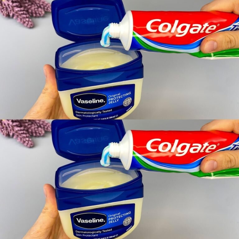 Toothpaste and Petroleum Jelly: Skin Care Facts, Preventive Healthcare, and Wellness 2026