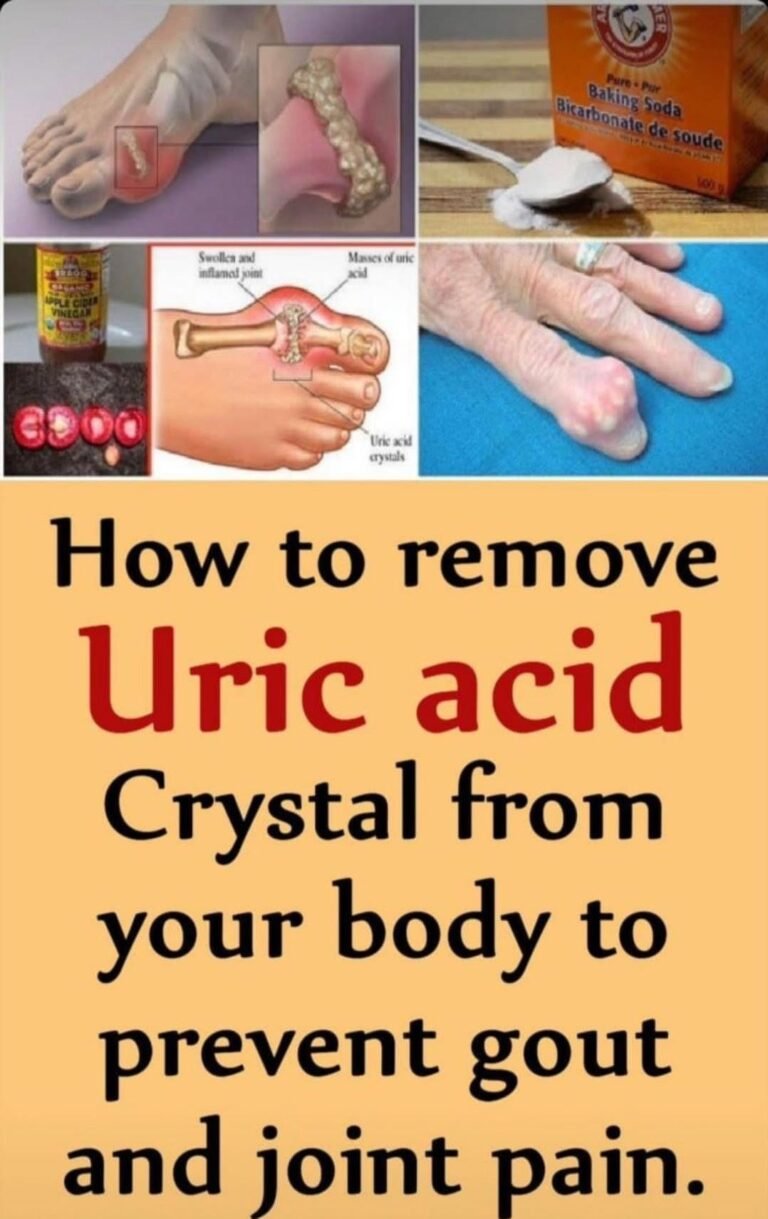 How to Help Lower Uric Acid Levels and Reduce the Risk of Gout
