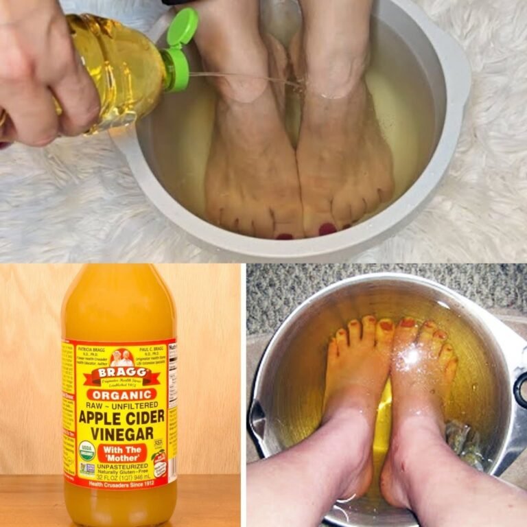 ACV Foot Soak: How to Do It Safely