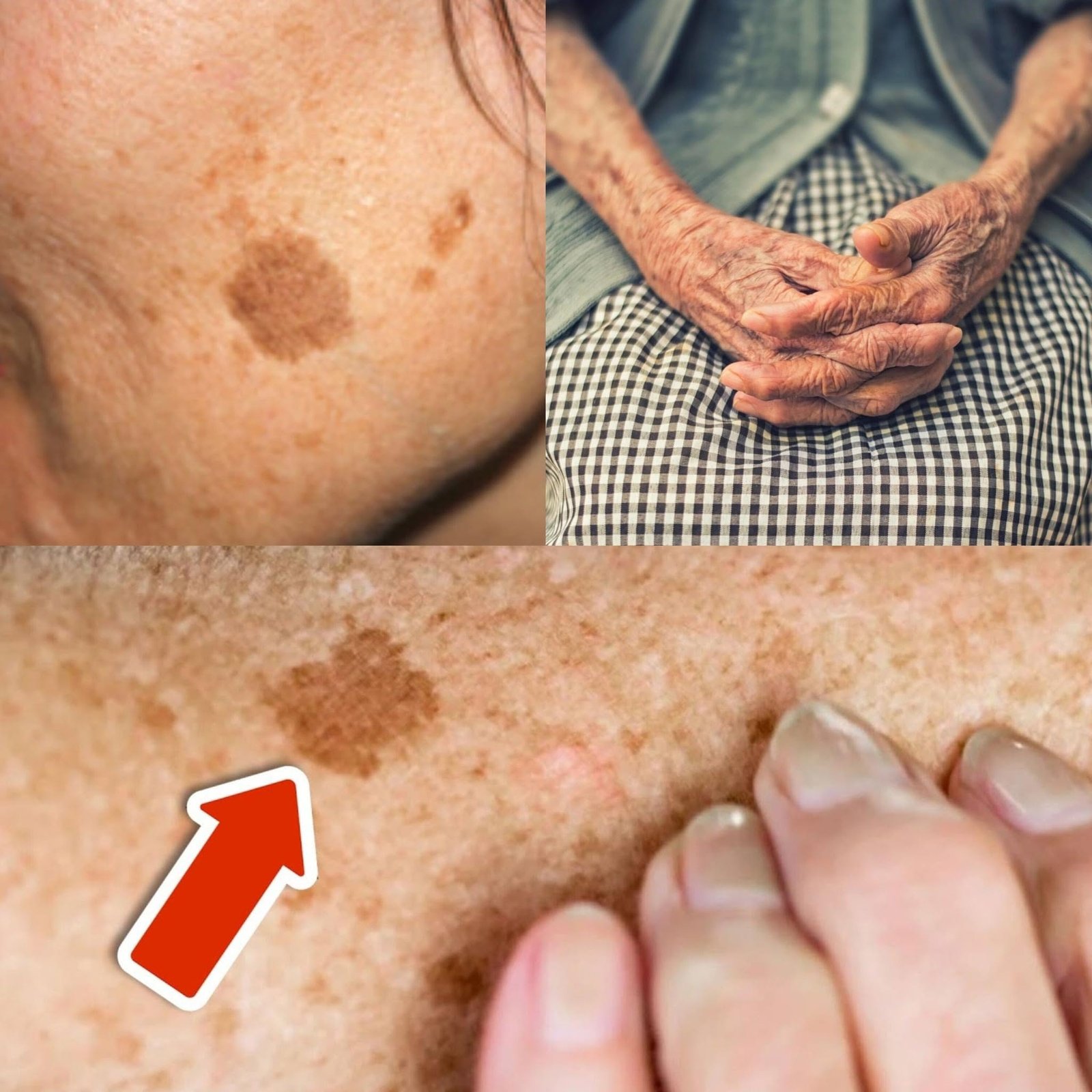 Age Spots and Skin Health 2026: Dermatology Care, Health Insurance, and Preventive Skincare Strategies