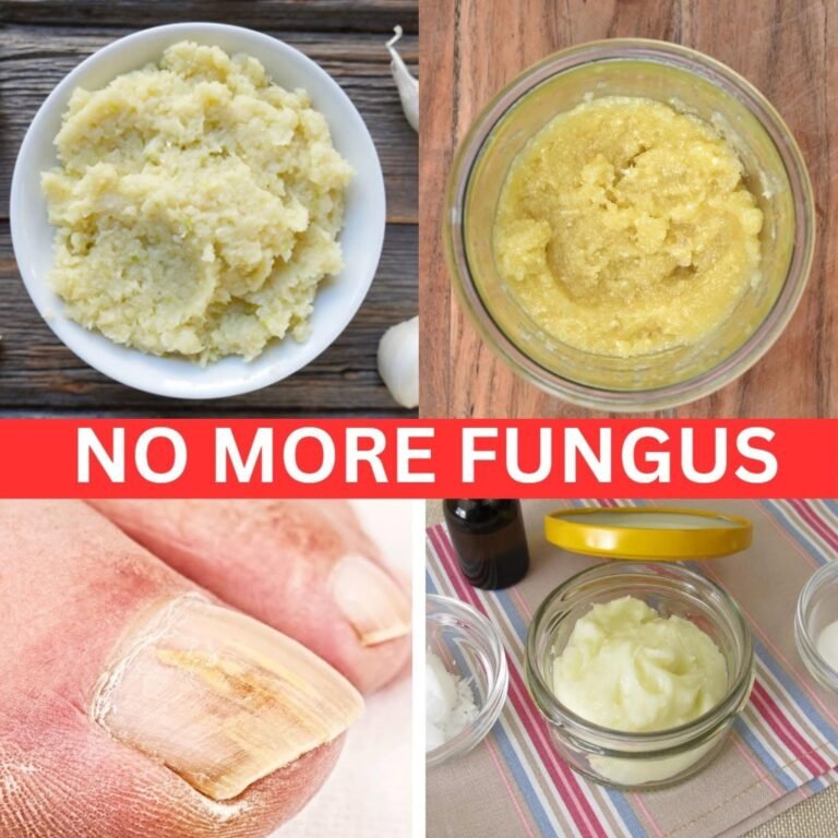 Garlic + Nail Care: What You Should Know