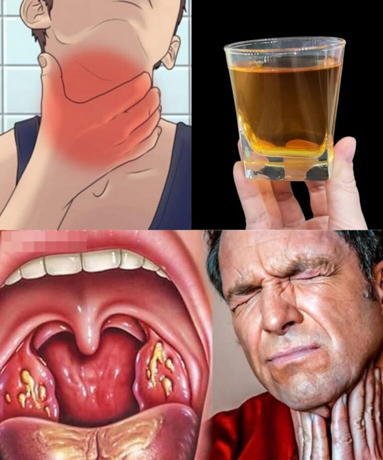 Natural Ways to Soothe a Sore Throat and Support Recovery 🌿