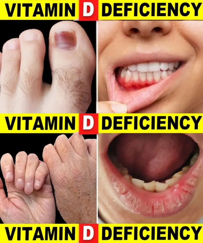 10 Signs Your Body May Need More Vitamin D 🌞
