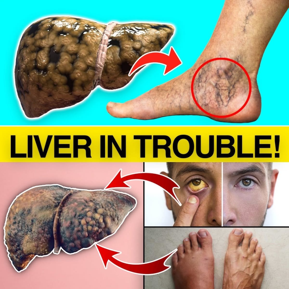 15 Early Warning Signs Your Liver Might Be in Trouble