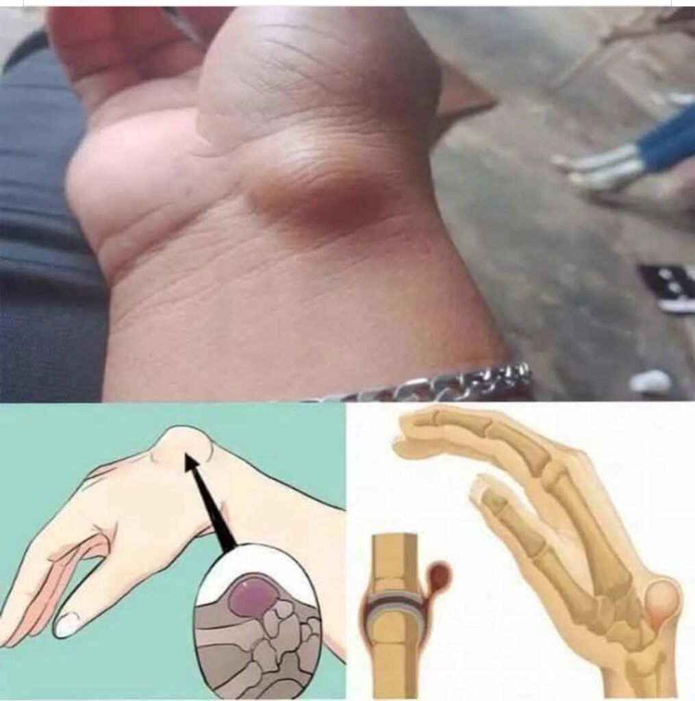 Wrist Lump: Causes, Symptoms, and When to See a Doctor