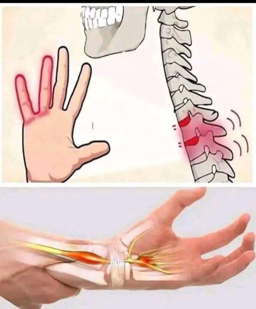 Numbness or Tingling in Your Hands: Common Causes, Symptoms, and When to See a Doctor
