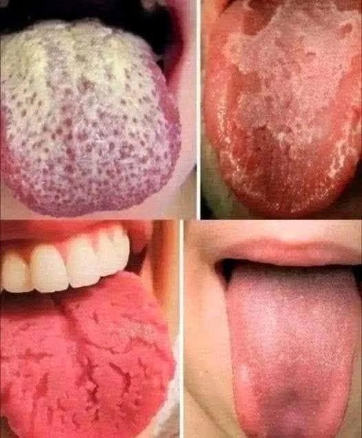 Tongue Health: What Your Tongue Can Tell You About Oral Wellness