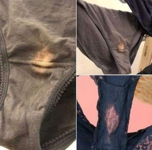 What Those Light Patches on Dark Underwear May Mean