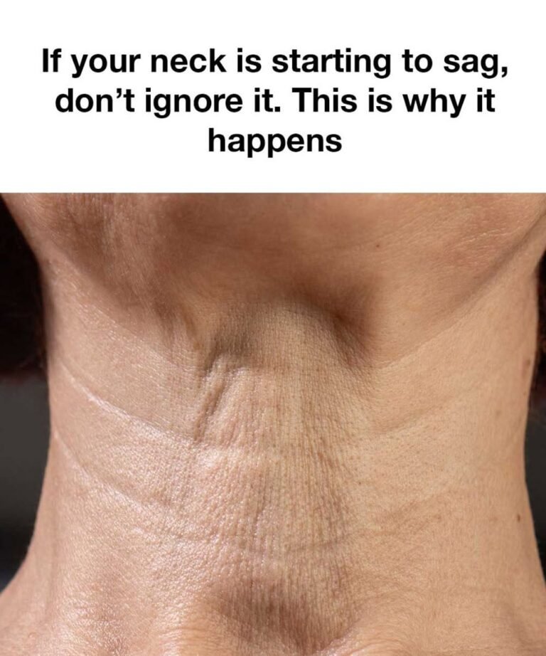 If Your Neck Is Starting to Sag, Don’t Ignore It: Here’s Why It Happens