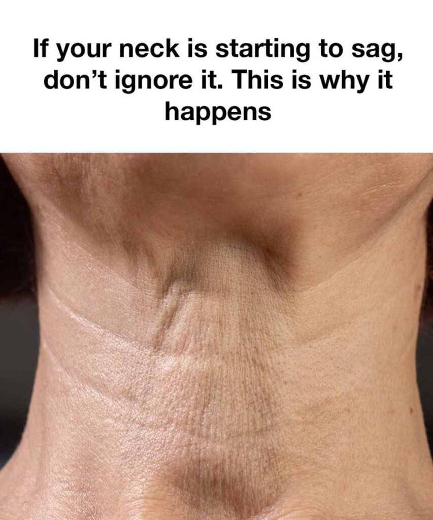 If Your Neck Is Starting to Sag, Don’t Ignore It: Here’s Why It Happens