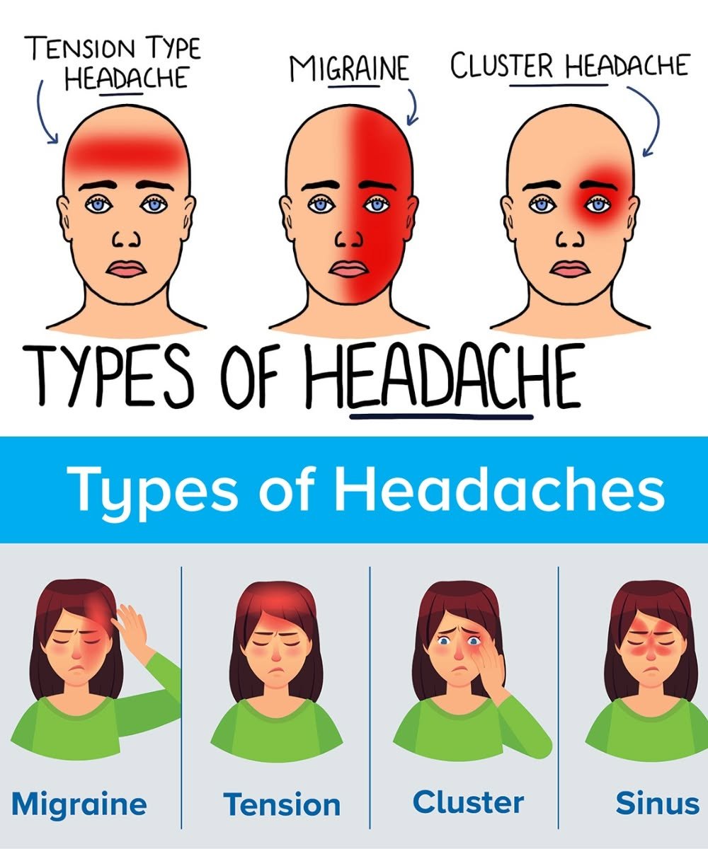 10 Common Types of Headaches: Causes, Symptoms, and Natural Ways to Find Relief