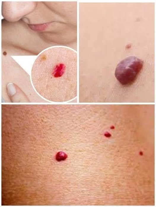 Red Dots on Your Skin: Common Causes, Symptoms, Treatment Options, and When to See a Doctor