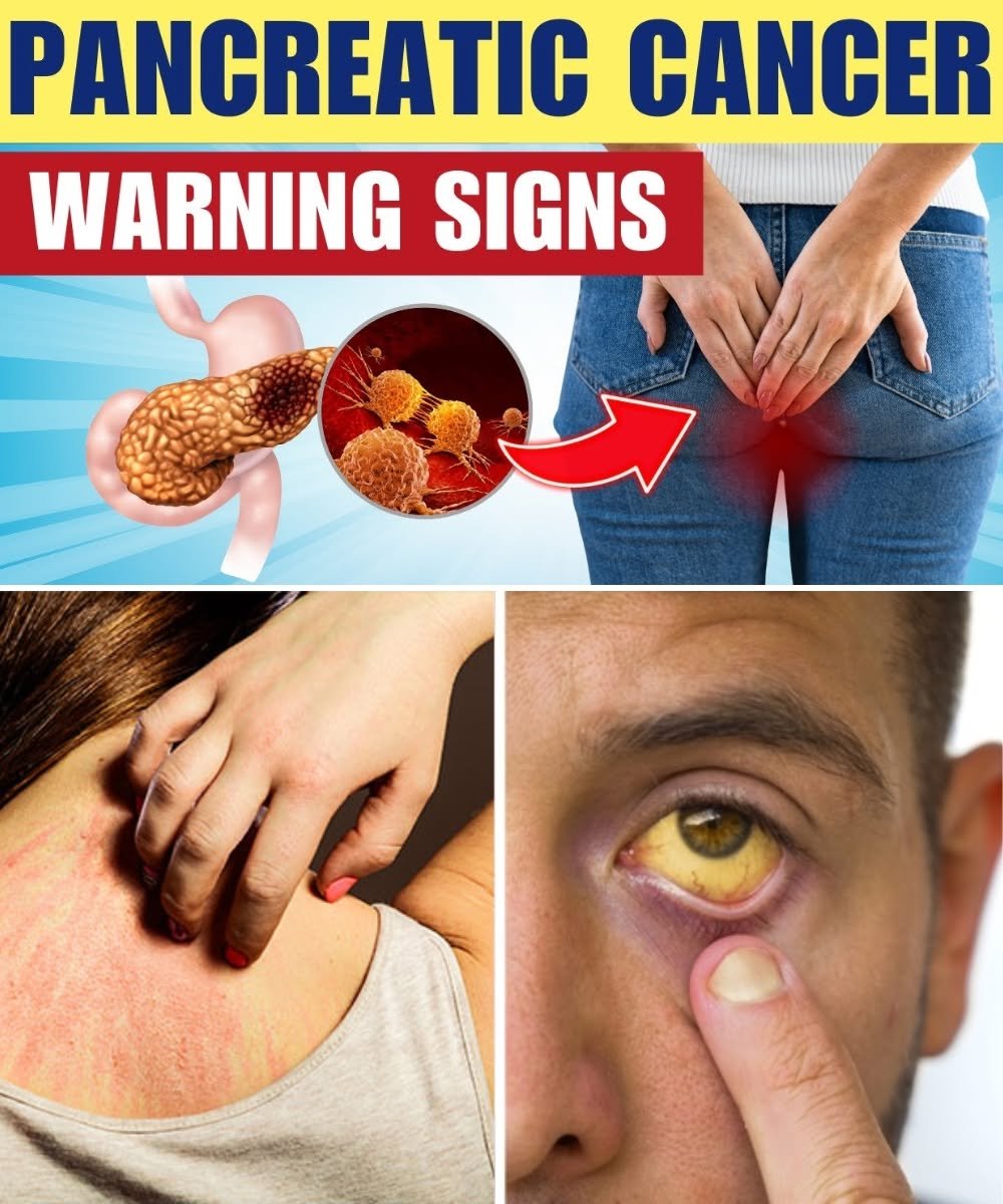 DON'T IGNORE! Top 8 Warning Signs Of Blood Clots