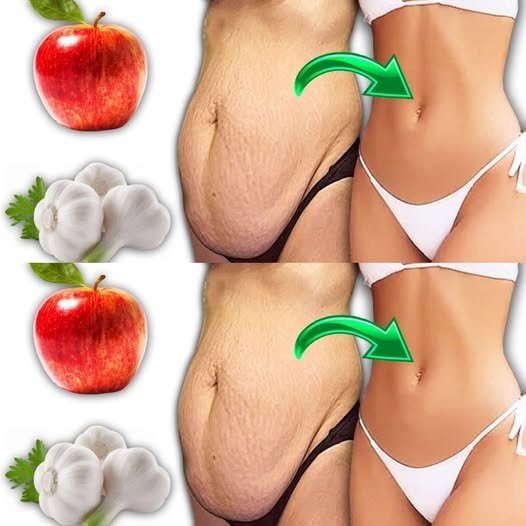 The Health Benefits of Garlic and Apples: A Natural Combination for Wellness