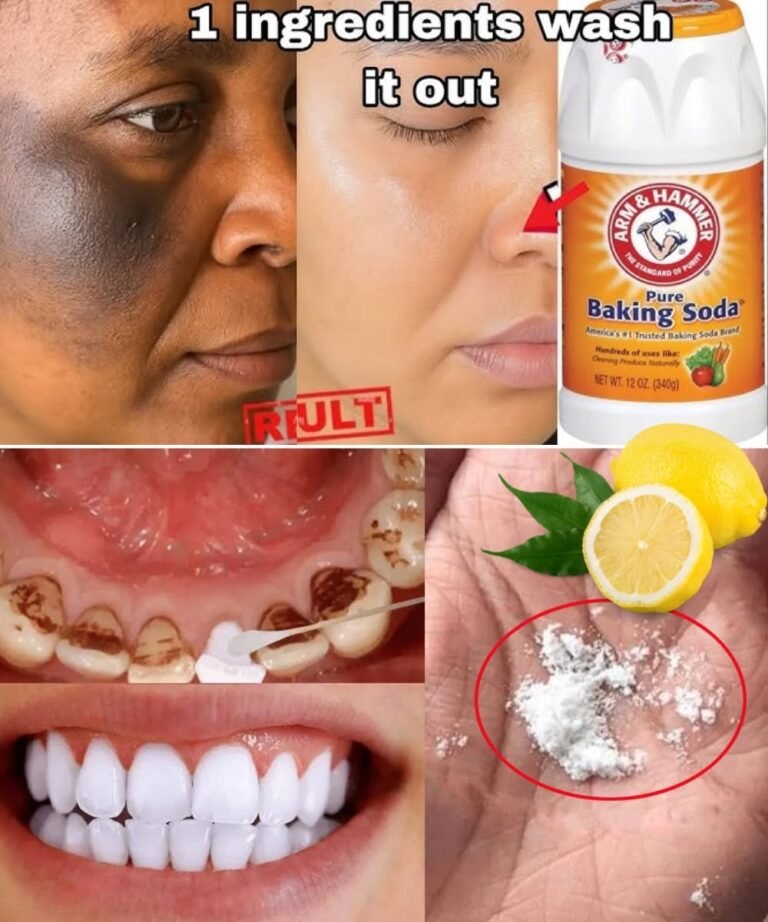 Mix Baking Soda with Lemon: 8 Surprising Benefits Every Woman Should Know