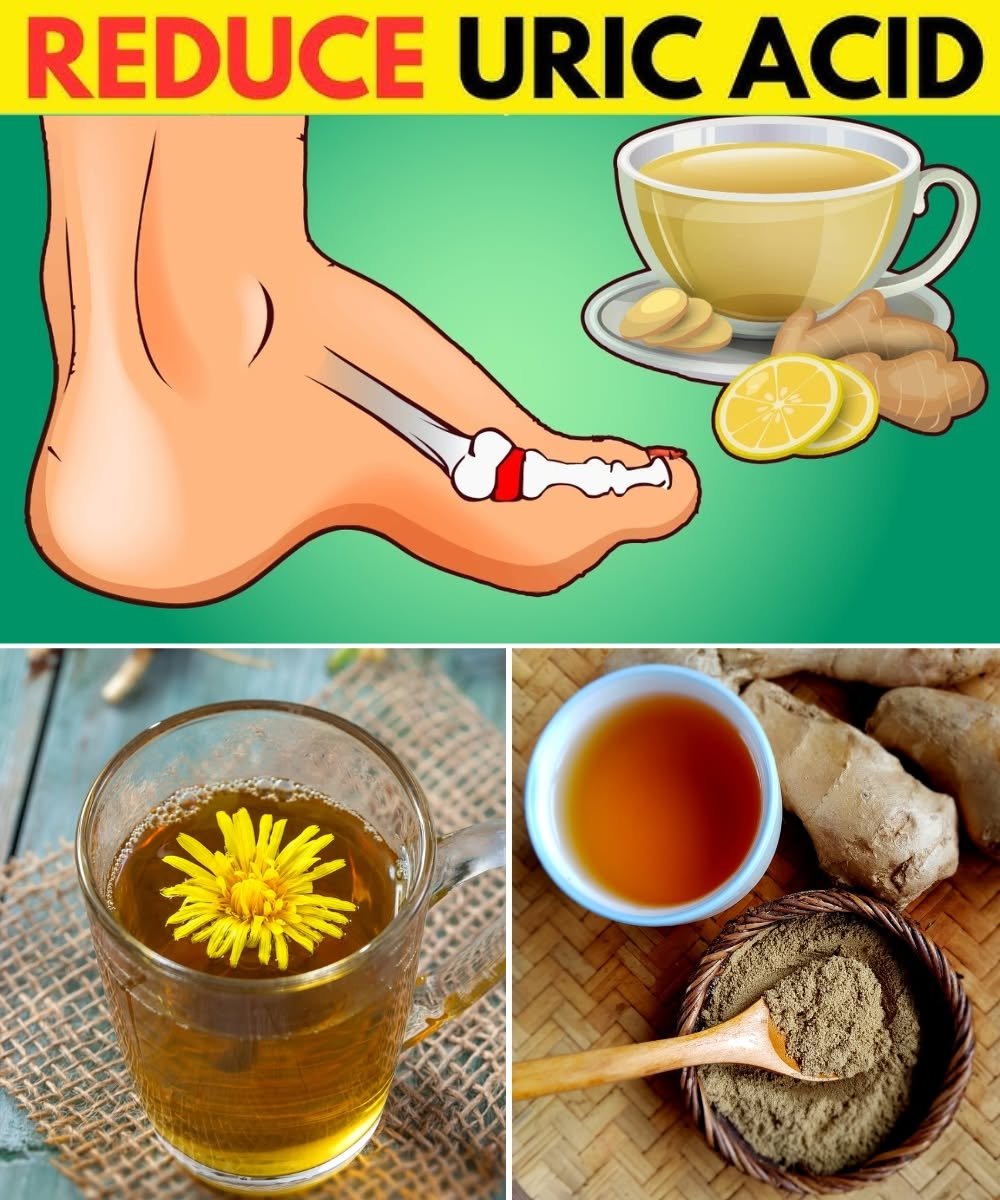 12 Herbal Teas That May Support Healthy Uric Acid Levels and Provide Natural Gout Relief