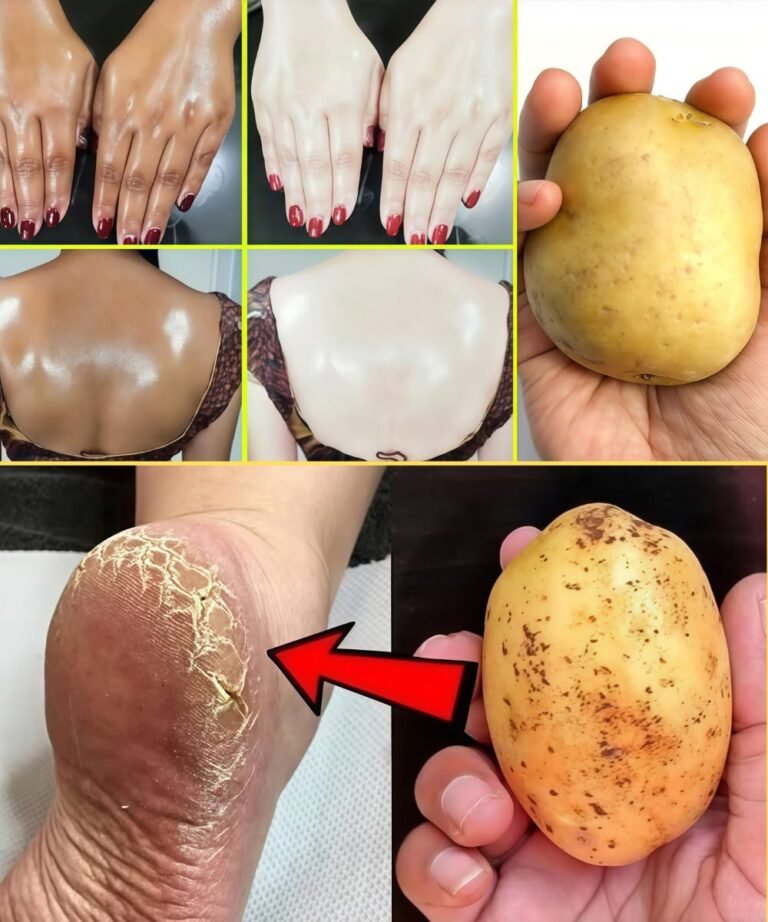 13 Genius Beauty Uses of Potatoes for Hair, Skin, Eyes, and More